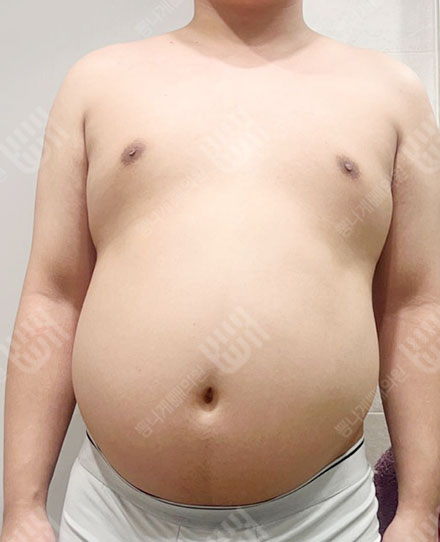 남자복부5 전