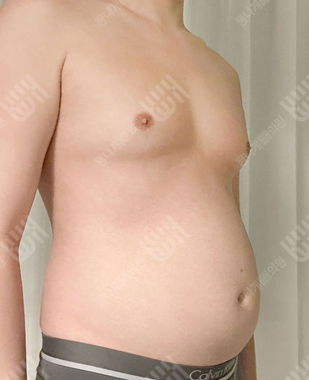 남자 복부 전