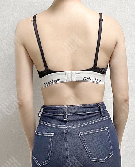 등지방흡입6 후