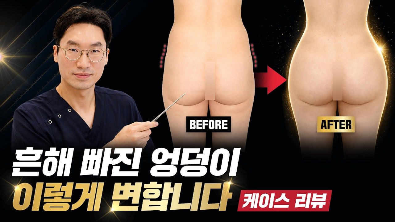 수술 케이스 리뷰ㅣ