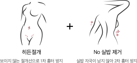 360˚ 흡입으로 완성하는 매끈한 팔뚝 라인
