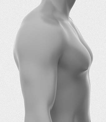팔뚝지방흡입 부유방 이미지