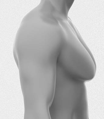 팔뚝지방흡입 부유방 이미지