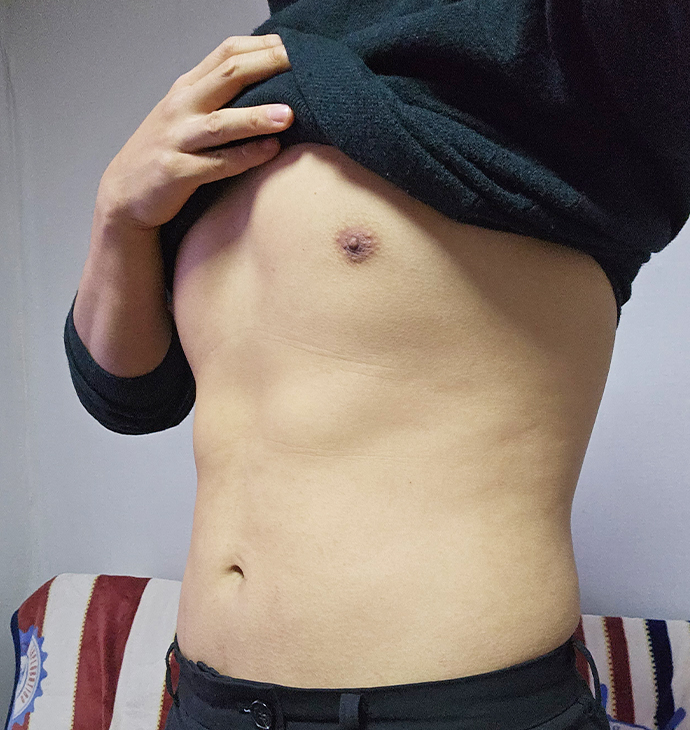 뽐나게빼의원 여유증